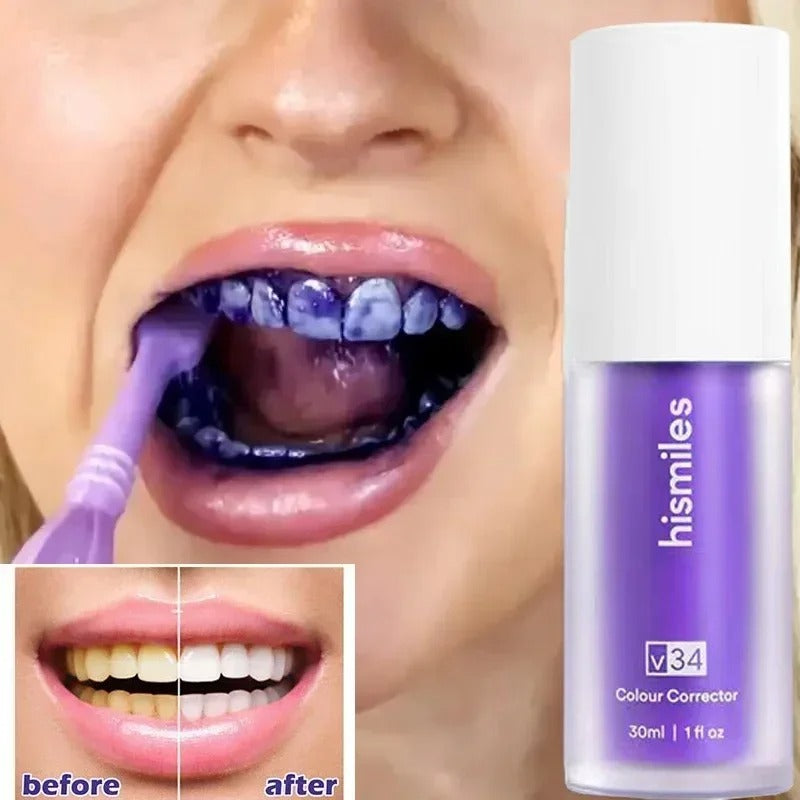 Teeth Brightening Hismiles V34 - Colour Corrector Serum 30ml