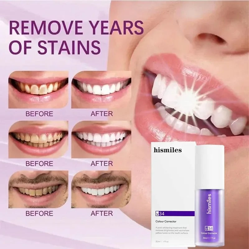 Teeth Brightening Hismiles V34 - Colour Corrector Serum 30ml